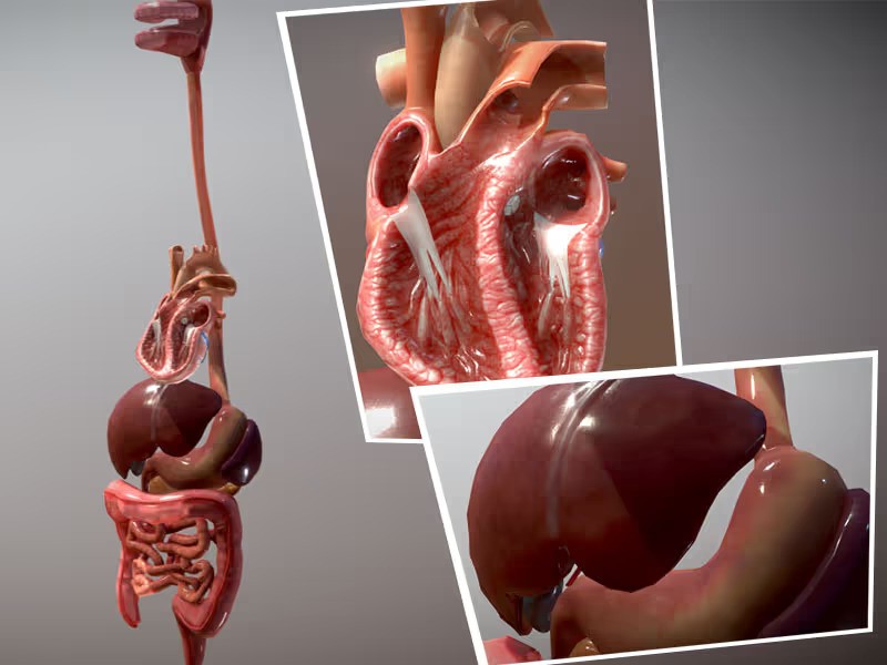 Portfolio of AR Kidney